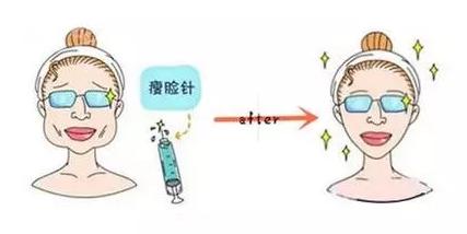 科普|光子嫩肤全攻略,做了光子后禁忌事项有哪些?