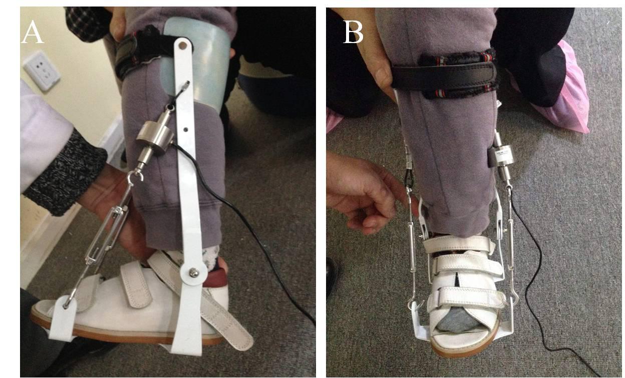 医院推荐儿童足外翻矫正鞋,脑瘫尖足矫正鞋