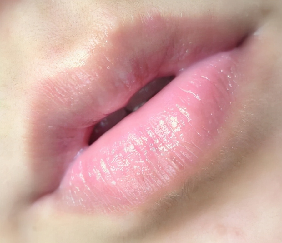 嘴唇水嘟嘟的太可爱了，但你的怎么还那么干瘪