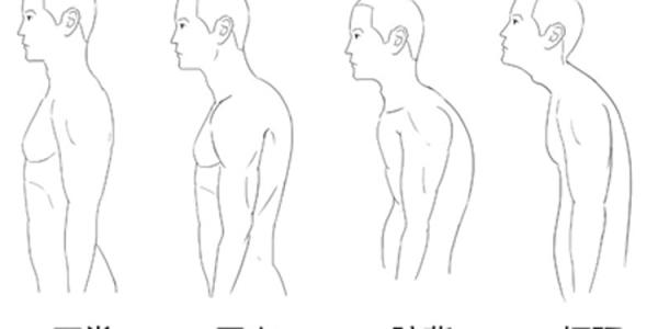 驼背的人怎么矫正,驼背的人怎样能变得不驼背