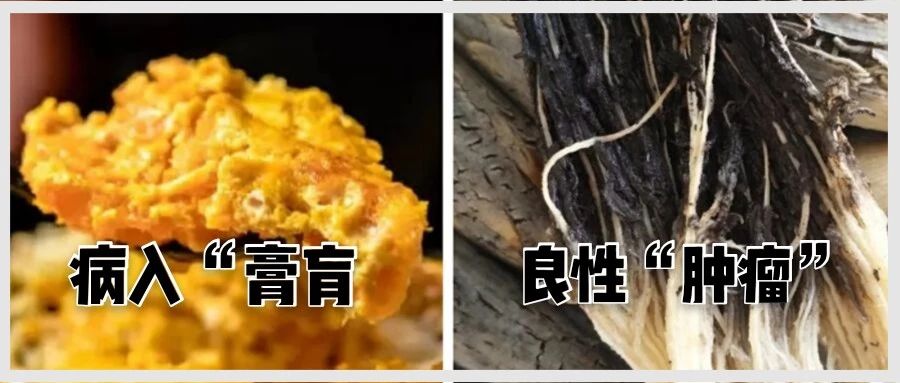 病入膏肓的吃货 (病入膏肓的美味)