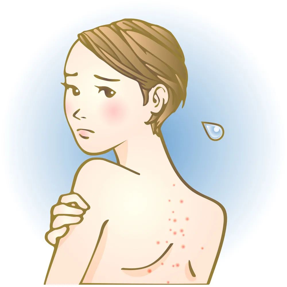 为什么面部会长痘痘别的地方不长,脸上长痘痘身上也有痘痘咋回事