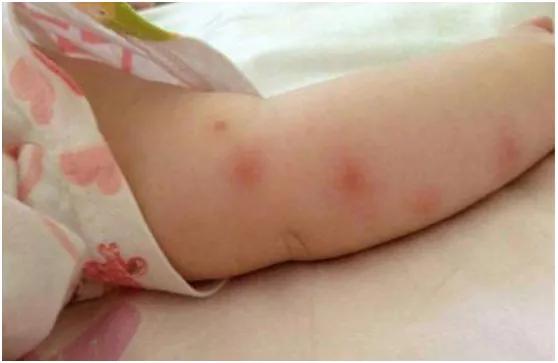 日本驱蚊产品哪个好,驱蚊靠谱的产品