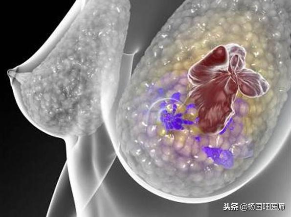 乳腺癌化疗后白细胞下降的症状,乳腺癌化疗后白细胞低有中药方吗