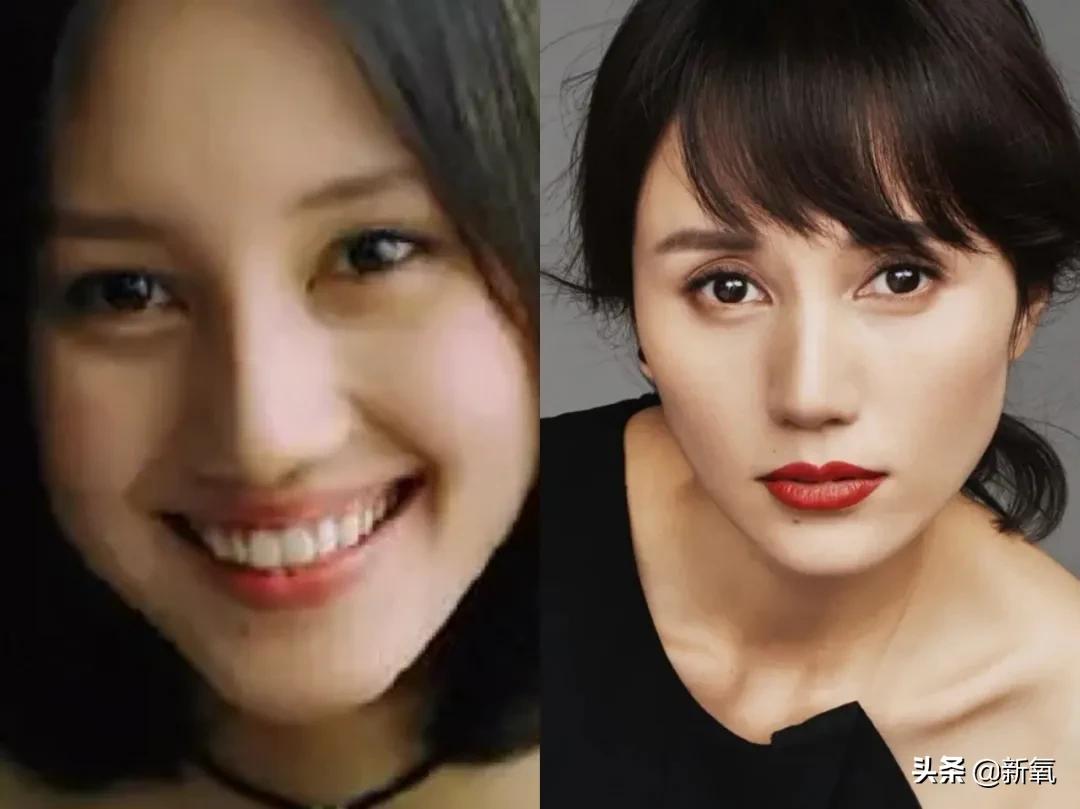 想加宽眉眼间距怎么修复,眉眼间距如何加宽