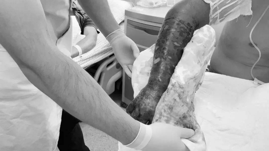 一名男子被蛇咬伤,男子被毒蛇咬伤比毒蛇还毒