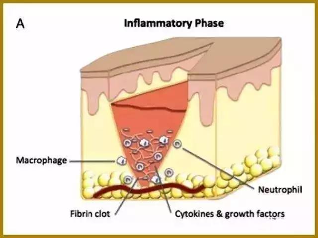 肛肠外科手术伤口护理,肛肠手术伤口换药用什么药好