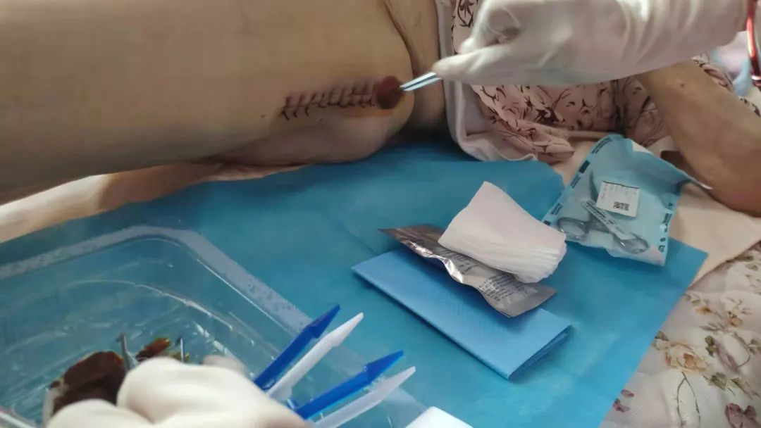 护理|医网情深护暖患心：云上相约为患解忧