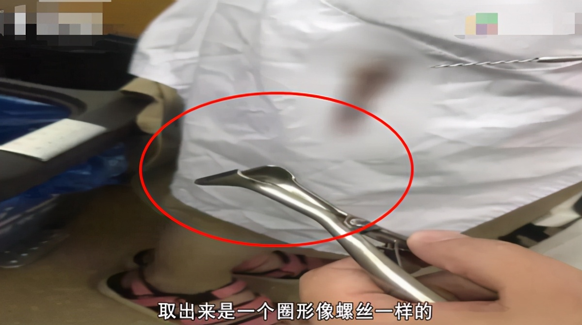 三岁女童裤子里有臭味,女童裤子发臭怎么办