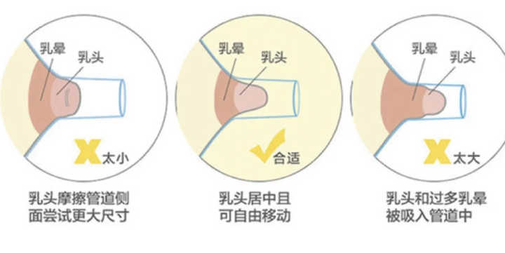 需不需要买吸奶器呢,吸奶器贵的和便宜的区别是啥