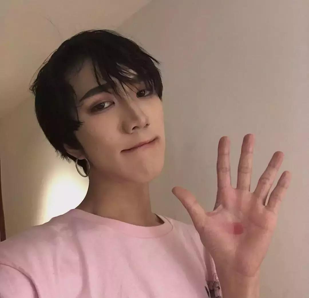 先天性唇裂男孩被抛弃,先天唇裂从小被母亲抛弃