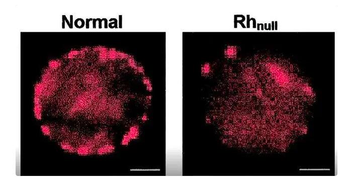科学家都想拥有的“黄*血金**”，全球仅43人拥有，是真正的万能血