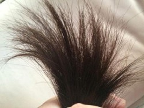 头发分叉怎么解决,头发分叉了不想剪有补救的办法吗