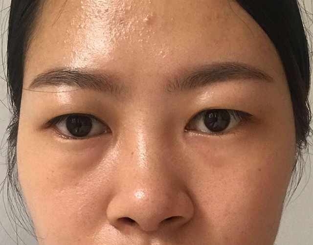 宝露斯补水产品,宝露斯护肤品好吗