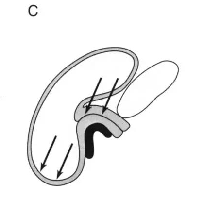 生完孩子盆底恢复不好会漏尿吗,盆底康复治疗漏尿有效果吗