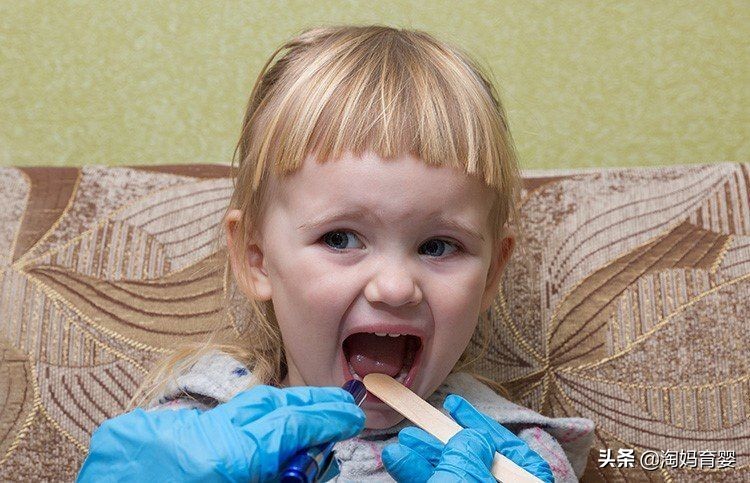 被鱼刺扎到喉咙喝醋吃馒头管用吗,鱼刺卡喉咙不能吞咽米饭和馒头