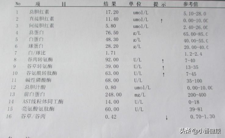 乙肝小三阳肝功能正常需要治疗吗,乙肝小三阳肝功能正常要注意什么