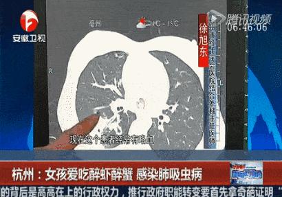 惊!三更半夜,孩子的“菊花”爬出了N条虫……