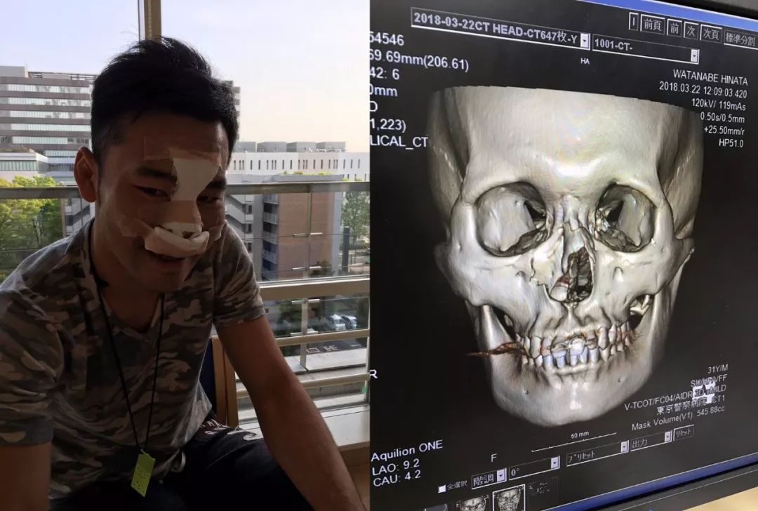 泰拳王江通猜的技术特点,江通猜vs古拉宾