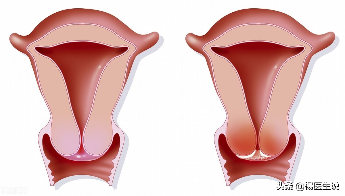 过早的行为危害,过早的性成熟有什么心理危害