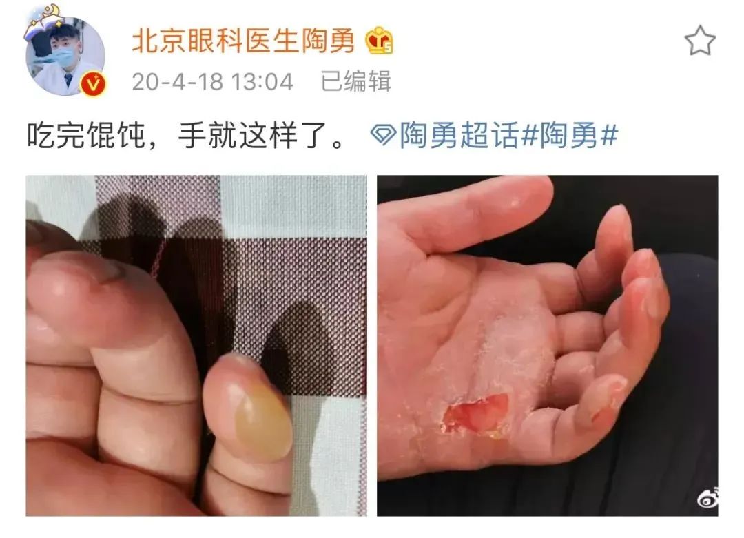 17岁陶勇被砍后续,陶勇被砍后首次出镜