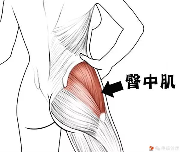 走路屁股扭来扭去是种病，还会导致腰痛、脚痛