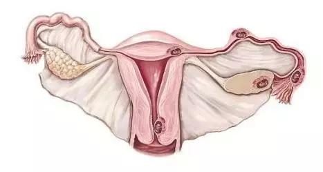 卵巢早衰，人易老！这5种表现都在告诉你：不保护就老了