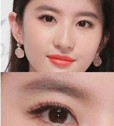 新月型双眼皮6.5毫米案例照片,自然款双眼皮有几种眼型图片