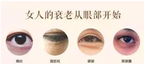 黑眼圈脂肪粒什么原因,眼部有细纹和黑眼圈的最简单方法