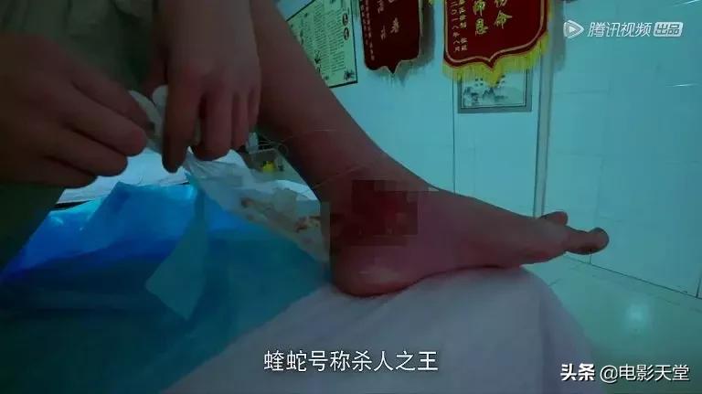 购买毒宠成瘾，甚至为此险些丧命，这是什么奇葩欲望？