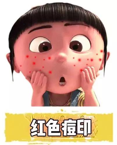 女生爆痘必买清单药膏,战痘用什么祛痘最好