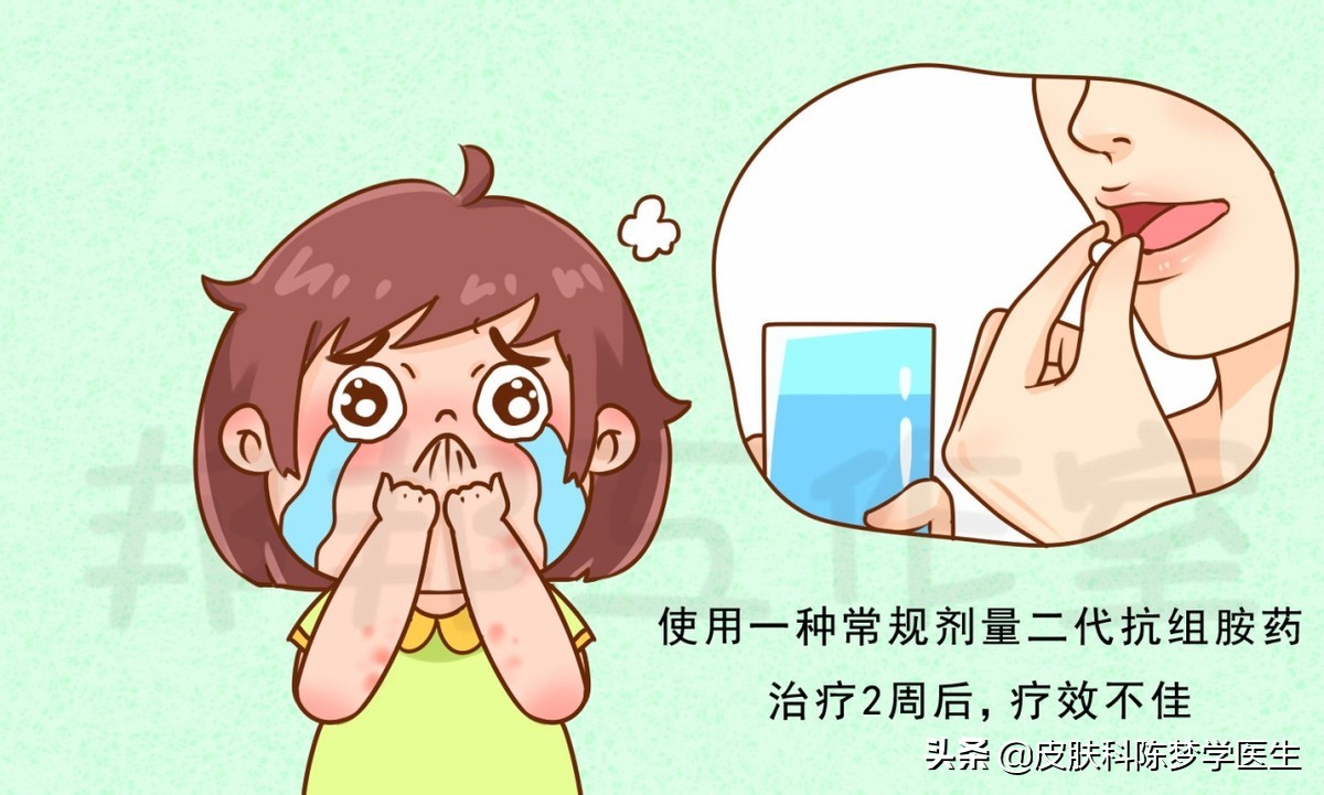 荨麻疹得了一年还可以治好吗,慢性荨麻疹治不好有什么后果