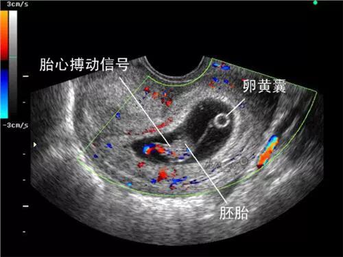 胎儿如何检查智力发育,b超单怎么看出胎儿boy还是girl
