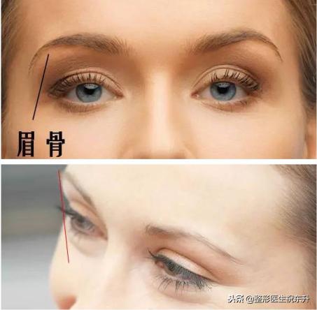 20岁眼睛凹陷是什么原因呢,眼眶会随着年龄变大凹陷