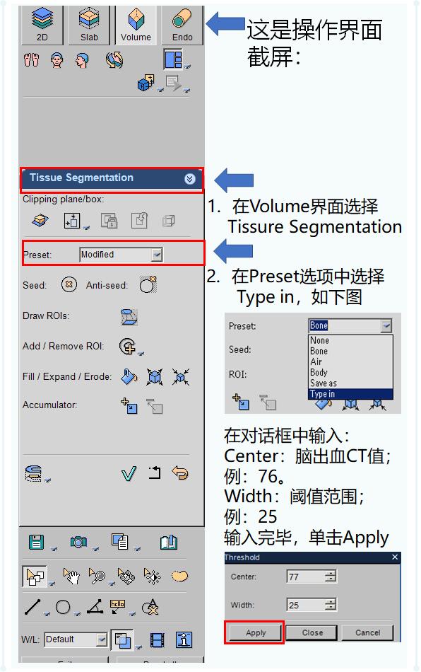 ct后处理重建技术,ct后处理技巧