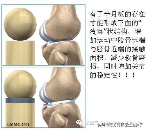 半月板损伤通常是单膝还是双膝,你知道半月板是什么吗