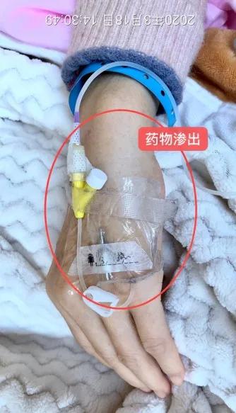 病人拒绝治疗护士怎么办,患者拒绝打留置针可以吗