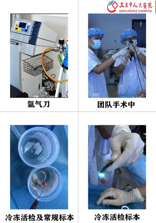 三亚市人民医院成功开展海南省首例支气管镜下冷冻活检术