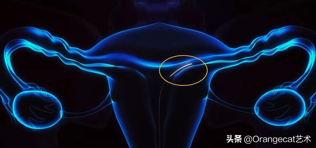 bbc尖端医疗的真相纪录片,纪录片尖端医疗的真相