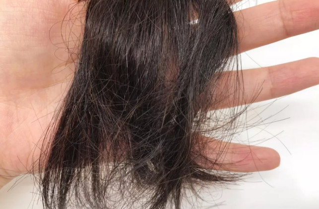 比较好用的德国防脱发,德国十大最好用的护肤品