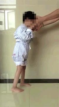 手术康复一体化,脑瘫康复训练10个方法图片