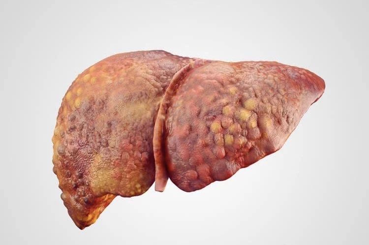 猫传染性肝炎用什么药治,猫得肝炎是什么症状