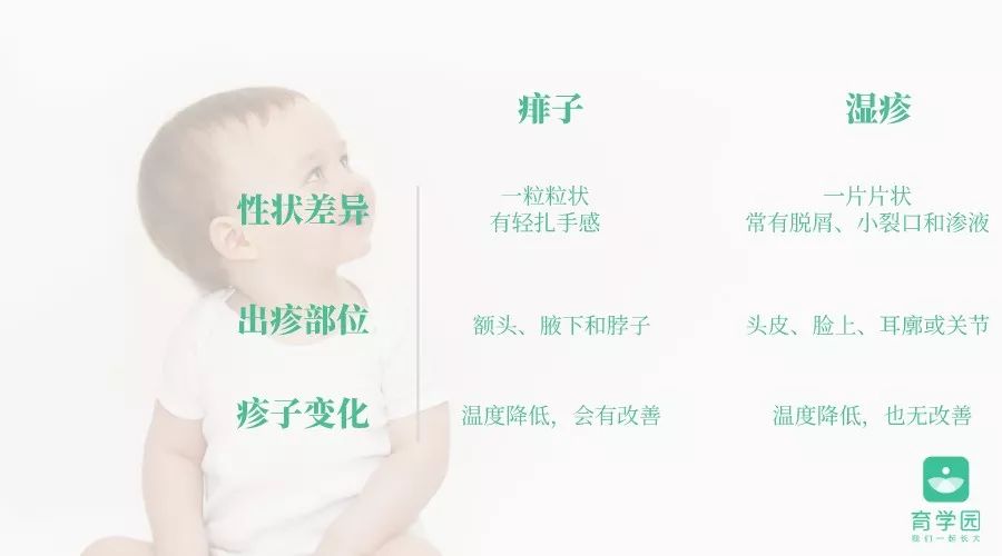 冬季婴儿痱子如何护理,孩子冬天起痱子了怎么最快消除