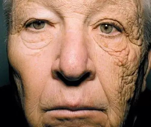 宝妈生娃前后对比,为什么生过孩子的宝妈特别显老