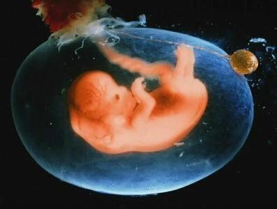 新生儿肺里有胎粪,新生儿肺部吸入胎粪怎么办