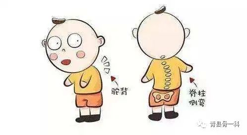 脊柱侧弯如何治疗才正确有效,先天性脊柱侧弯最好的恢复方法