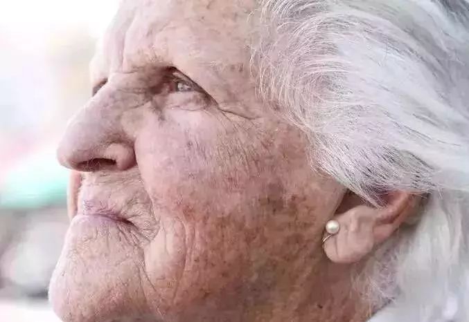 祛斑要注意哪些事项,祛斑为什么会越祛越多