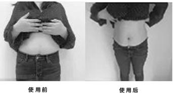 ECHAI智能康复运动仪，为您解决产后腹部松弛赘肉等问题