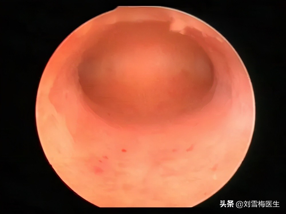 刘雪梅医生视频,刘雪梅大夫