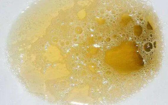 肾虚吃腰子能补肾吗,腰子和枸杞能补肾吗